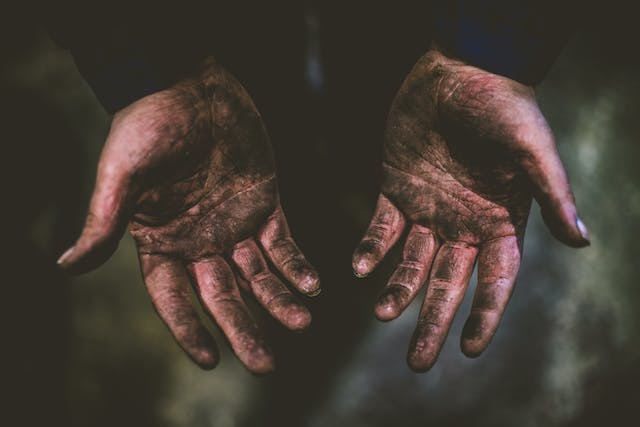 Hold Fast: Taking Care of the Hands That Provide
